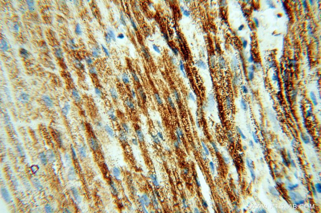 PDH E1 alpha Antibody in Immunohistochemistry (Paraffin) (IHC (P))