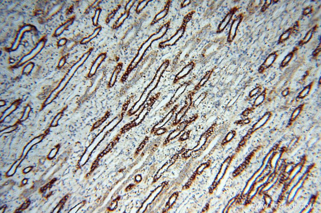 PDH E1 alpha Antibody in Immunohistochemistry (Paraffin) (IHC (P))