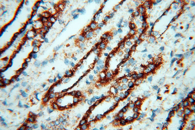 PDH E1 alpha Antibody in Immunohistochemistry (Paraffin) (IHC (P))