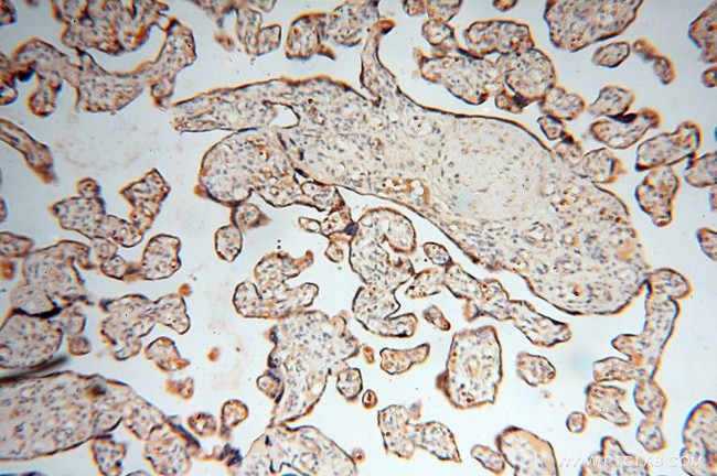 PDH E1 alpha Antibody in Immunohistochemistry (Paraffin) (IHC (P))