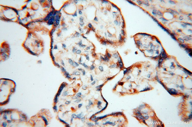 PDH E1 alpha Antibody in Immunohistochemistry (Paraffin) (IHC (P))