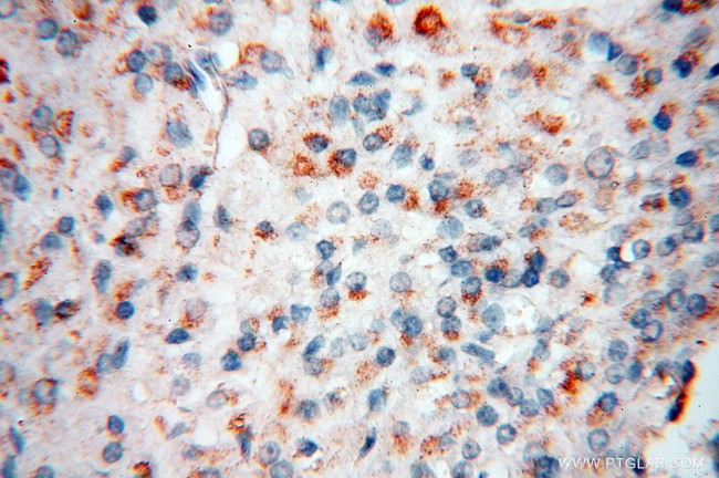 PDH E1 alpha Antibody in Immunohistochemistry (Paraffin) (IHC (P))