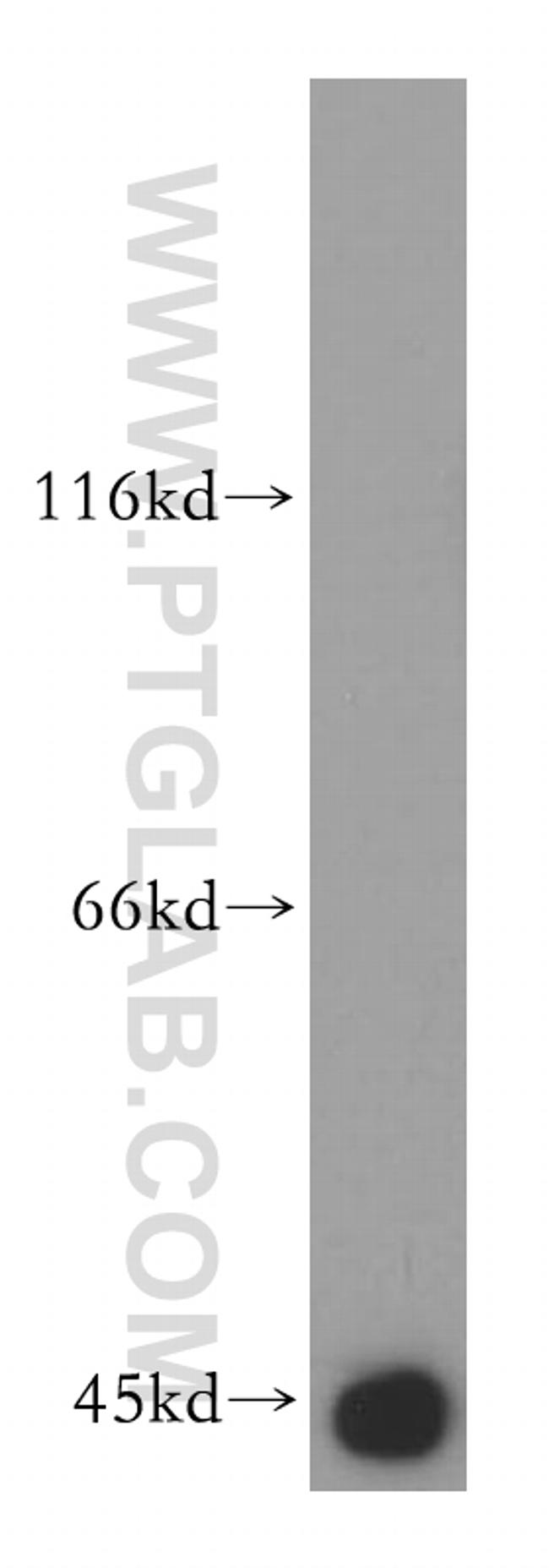 PDH E1 alpha Antibody in Western Blot (WB)