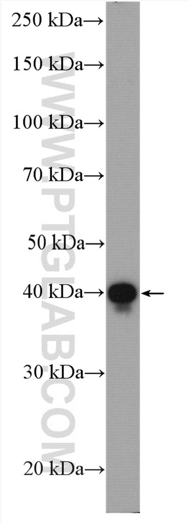 PDH E1 alpha Antibody in Western Blot (WB)