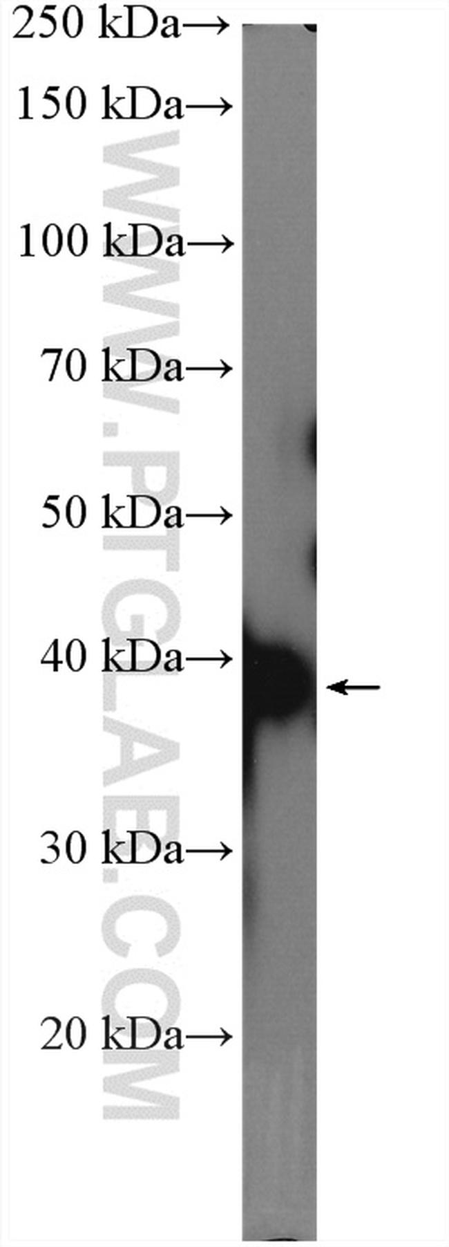 PDH E1 alpha Antibody in Western Blot (WB)