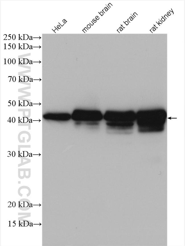 PDH E1 alpha Antibody in Western Blot (WB)