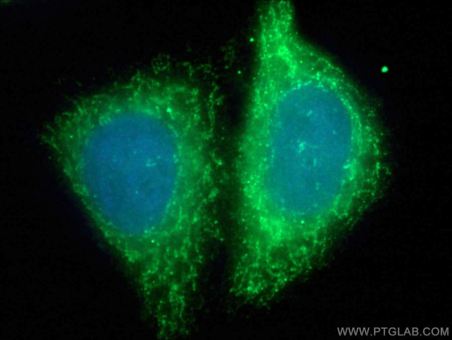 PDH E1 alpha Antibody in Immunocytochemistry (ICC/IF)