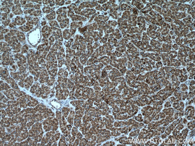 PDH E1 alpha Antibody in Immunohistochemistry (Paraffin) (IHC (P))