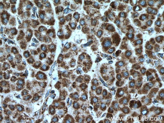 PDH E1 alpha Antibody in Immunohistochemistry (Paraffin) (IHC (P))