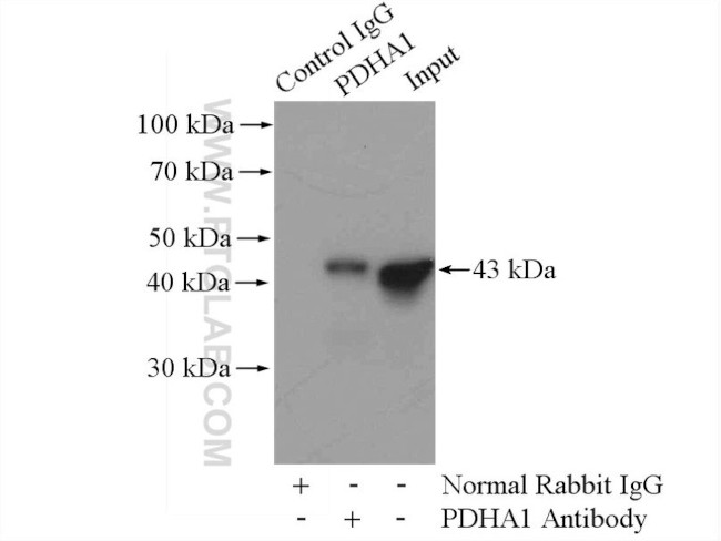 PDH E1 alpha Antibody in Immunoprecipitation (IP)