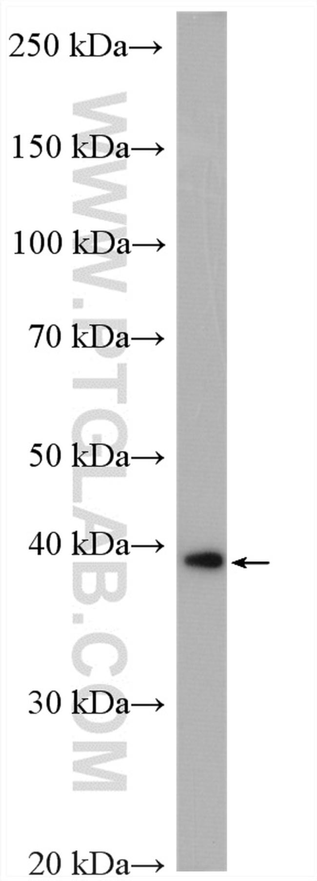 PDH E1 alpha Antibody in Western Blot (WB)