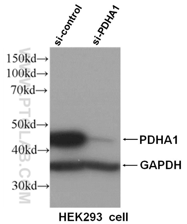 PDH E1 alpha Antibody in Western Blot (WB)