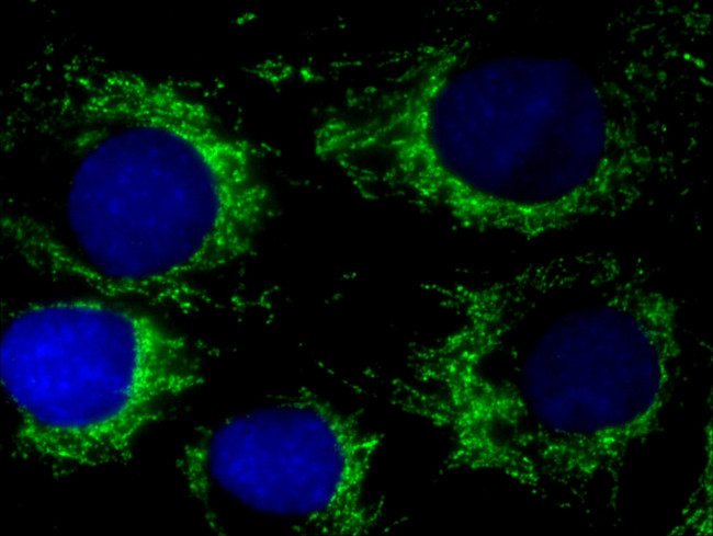 PDH E1 alpha Antibody in Immunocytochemistry (ICC/IF)