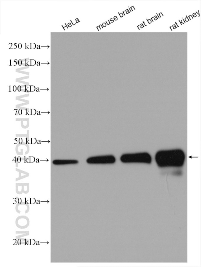 PDH E1 alpha Antibody in Western Blot (WB)