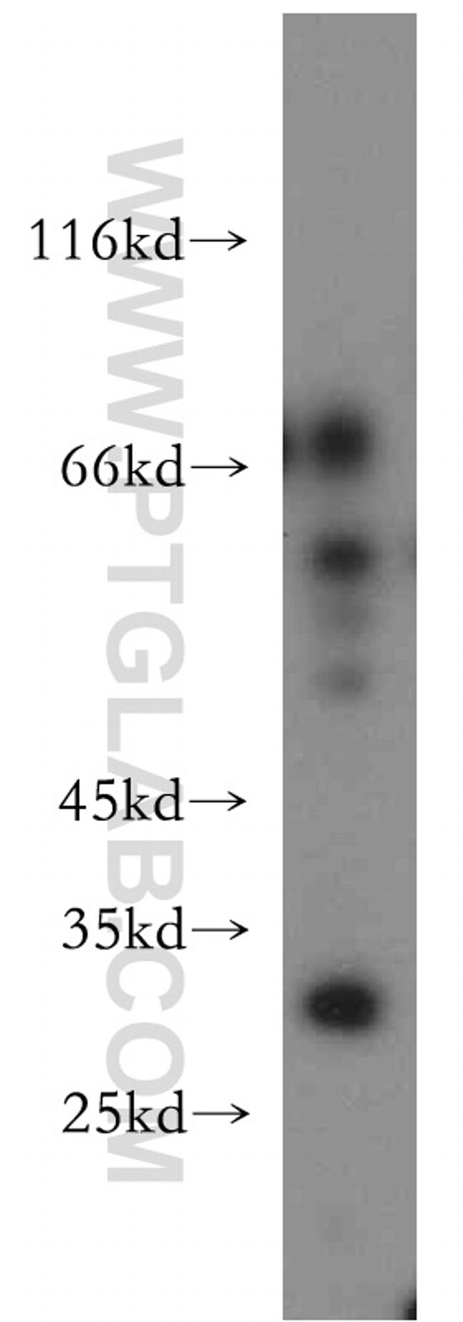 COX18 Antibody in Western Blot (WB)