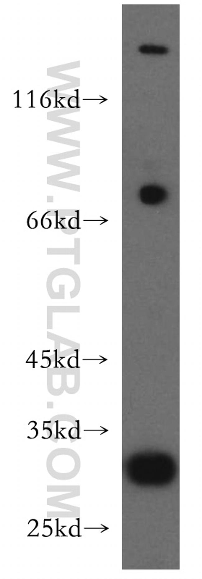 COX18 Antibody in Western Blot (WB)