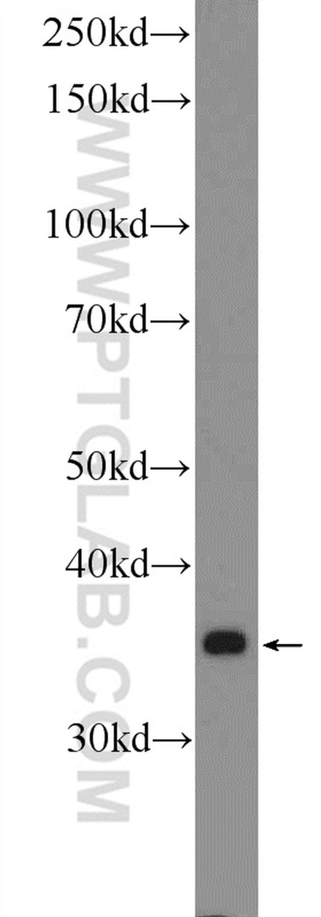 COX18 Antibody in Western Blot (WB)