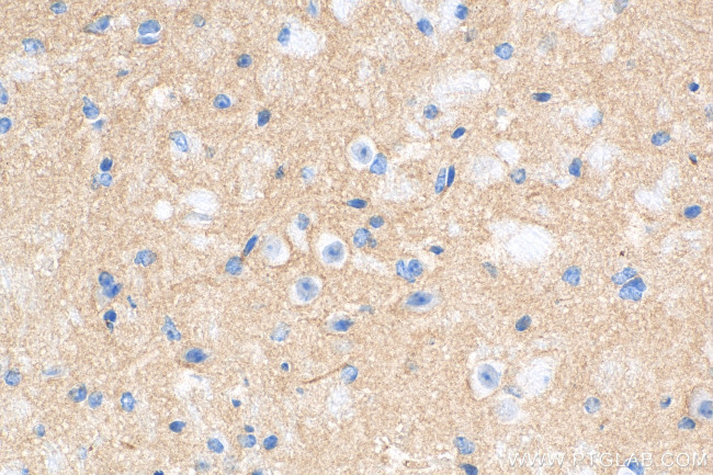 PDE10A Antibody in Immunohistochemistry (Paraffin) (IHC (P))