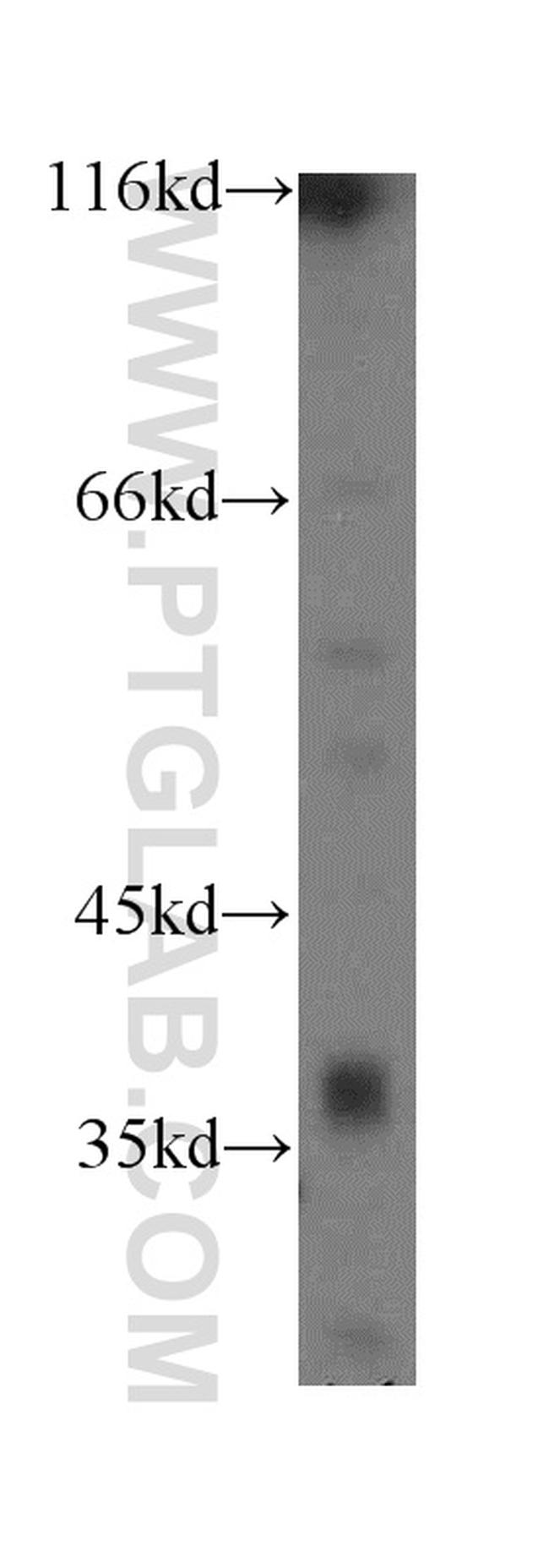 PGLYRP3 Antibody in Western Blot (WB)