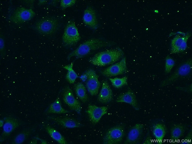 Neurotrophin 3 Antibody in Immunocytochemistry (ICC/IF)