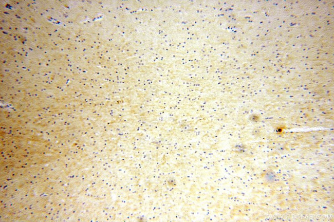 Neurotrophin 3 Antibody in Immunohistochemistry (Paraffin) (IHC (P))