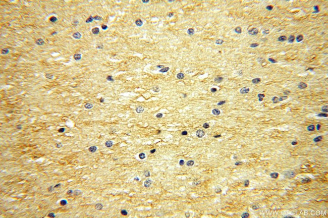 Neurotrophin 3 Antibody in Immunohistochemistry (Paraffin) (IHC (P))