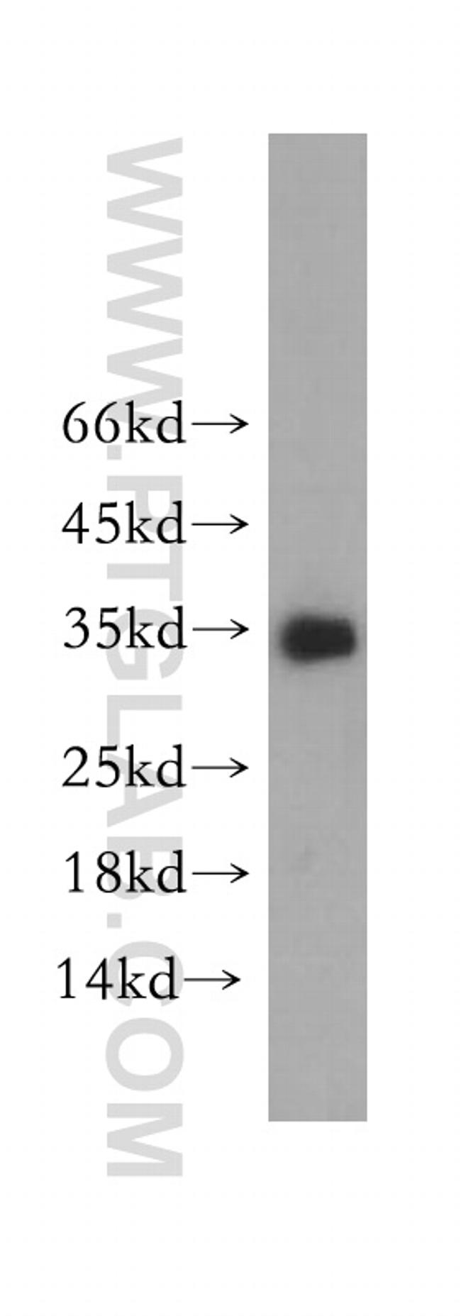 Neurotrophin 3 Antibody in Western Blot (WB)