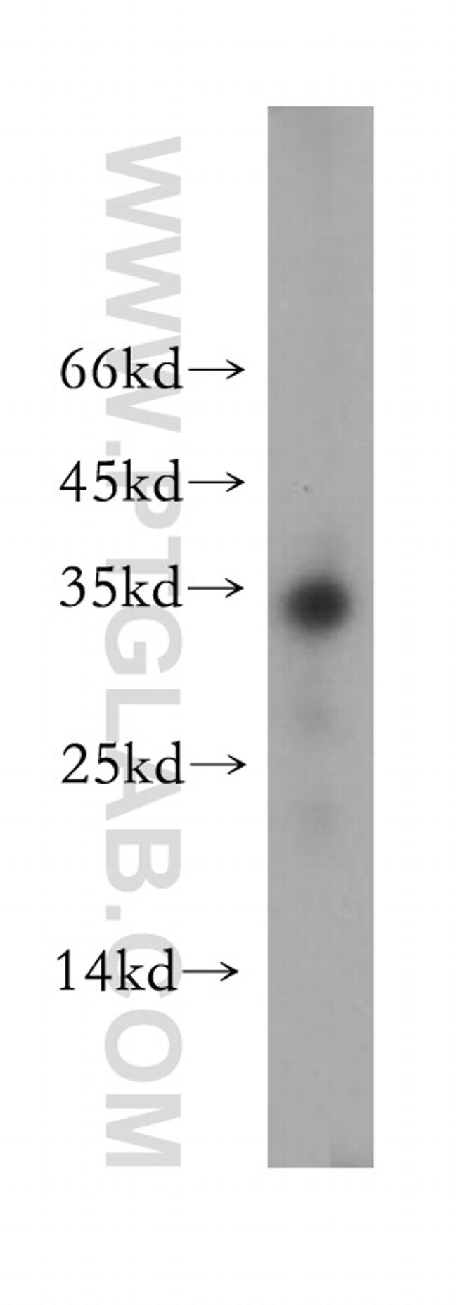 Neurotrophin 3 Antibody in Western Blot (WB)