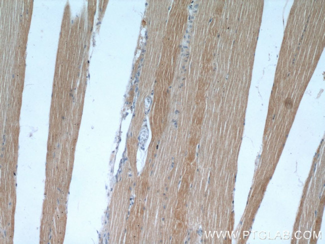 PLA2G4E Antibody in Immunohistochemistry (Paraffin) (IHC (P))