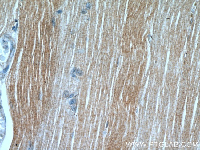 PLA2G4E Antibody in Immunohistochemistry (Paraffin) (IHC (P))