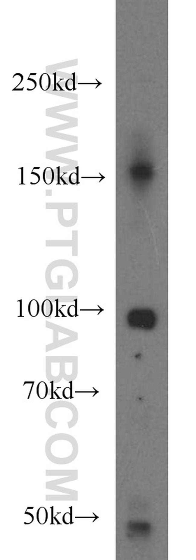 PLA2G4E Antibody in Western Blot (WB)