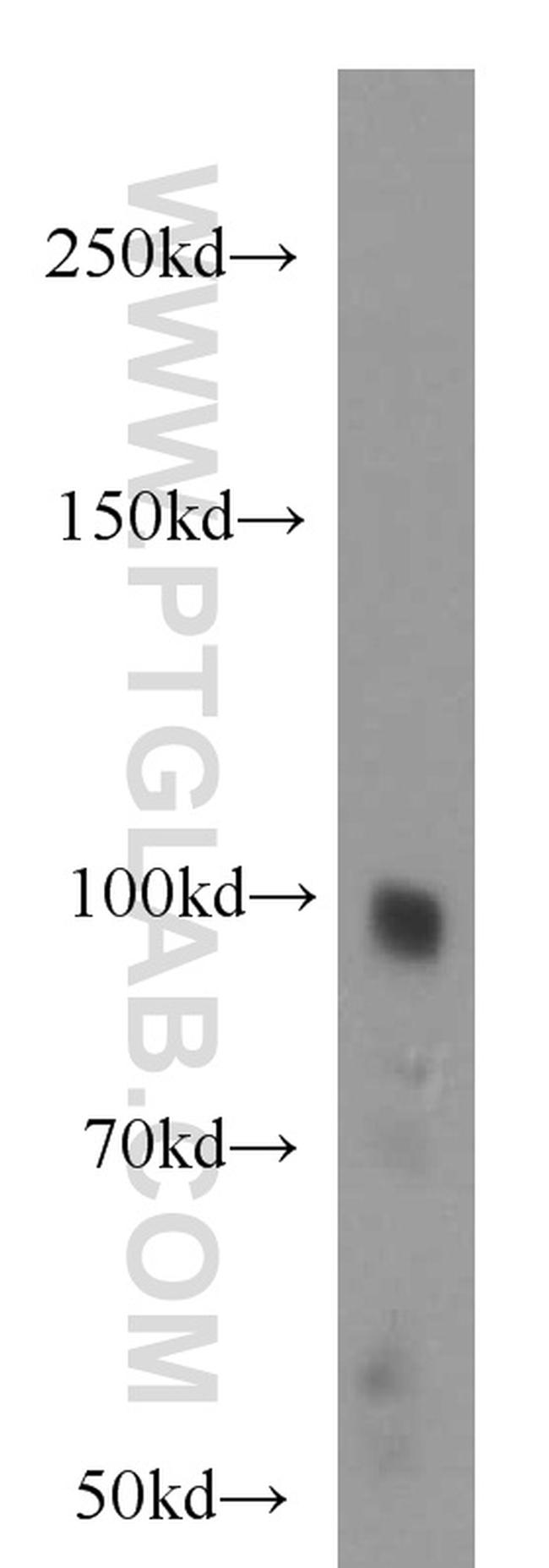 PLA2G4E Antibody in Western Blot (WB)