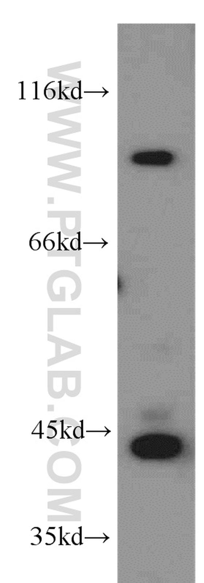 PLA2G4E Antibody in Western Blot (WB)