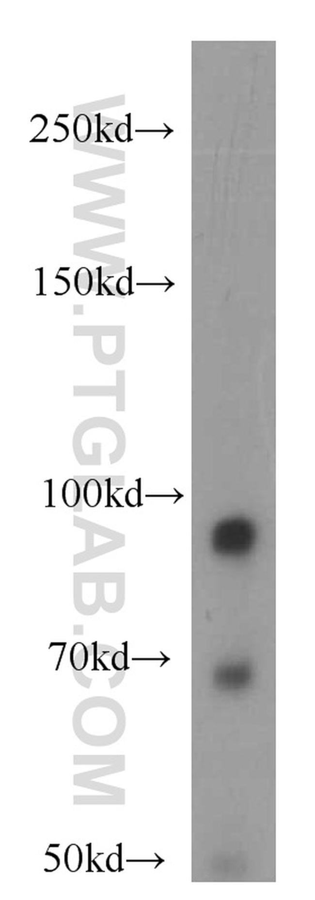 PLA2G4E Antibody in Western Blot (WB)