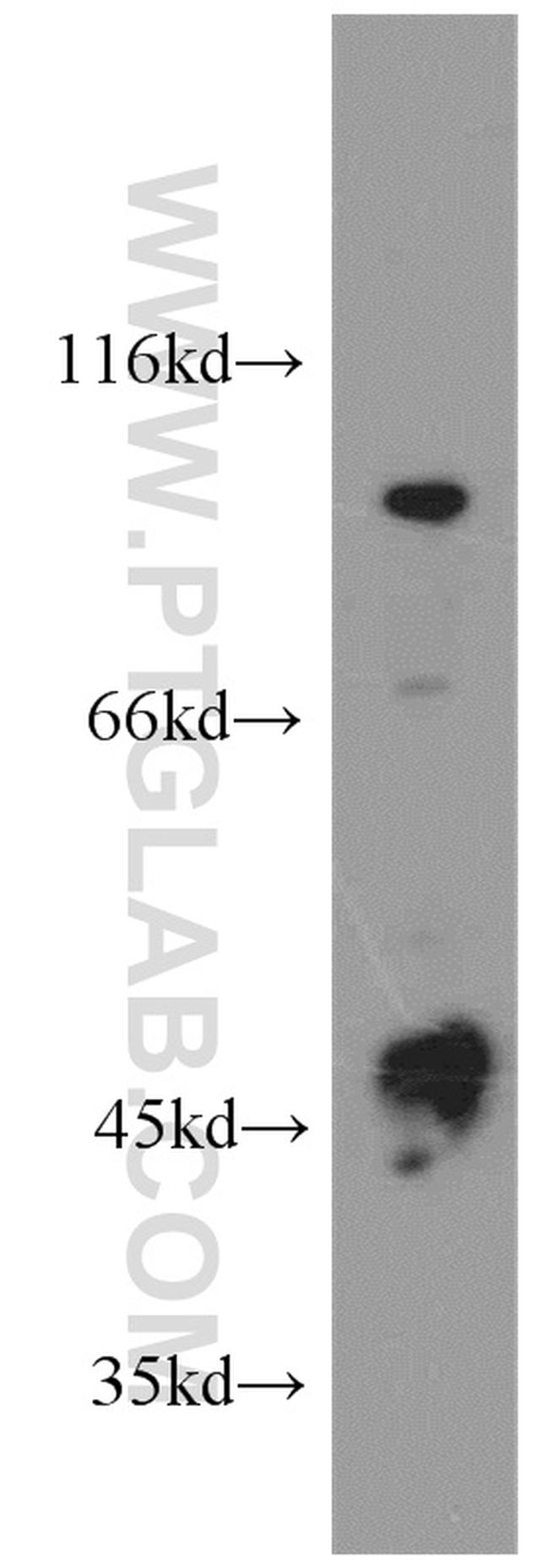 PLA2G4E Antibody in Western Blot (WB)