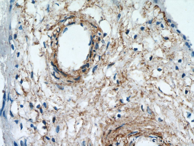 KCNC4 Antibody in Immunohistochemistry (Paraffin) (IHC (P))