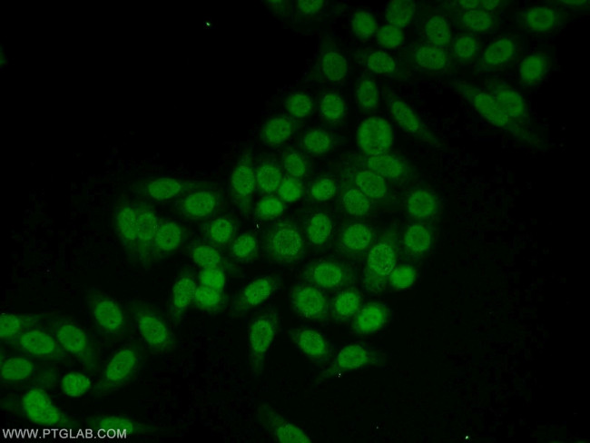 CLOCK Antibody in Immunocytochemistry (ICC/IF)