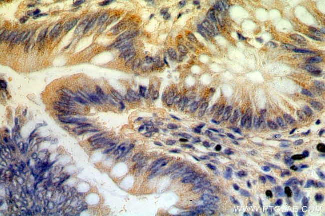 B3GNT3 Antibody in Immunohistochemistry (Paraffin) (IHC (P))