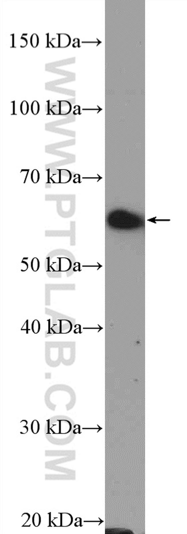 TRAF3 Antibody in Western Blot (WB)