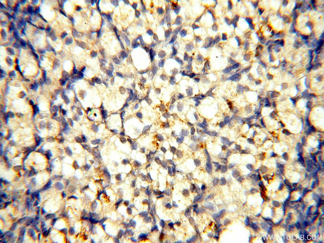 SGCG Antibody in Immunohistochemistry (Paraffin) (IHC (P))