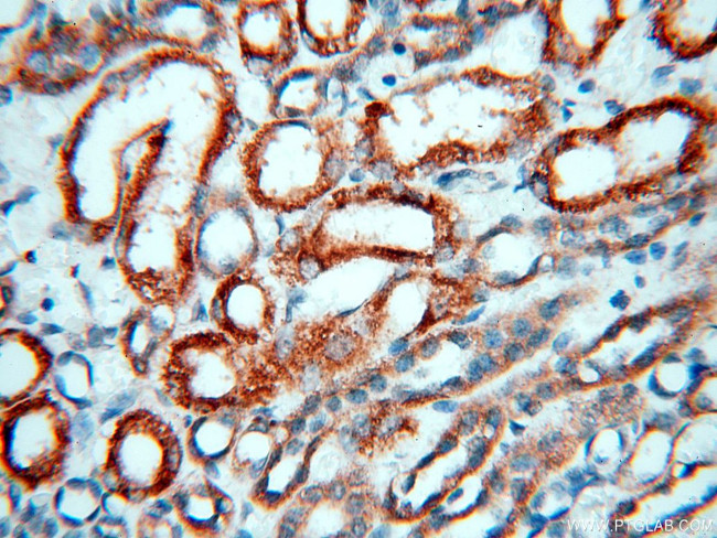 SGCG Antibody in Immunohistochemistry (Paraffin) (IHC (P))