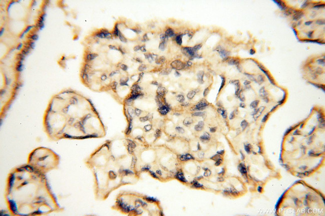 SGCG Antibody in Immunohistochemistry (Paraffin) (IHC (P))