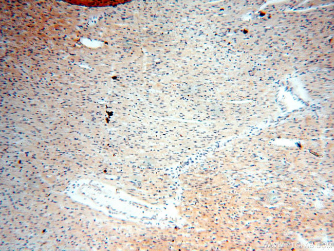 SGCG Antibody in Immunohistochemistry (Paraffin) (IHC (P))