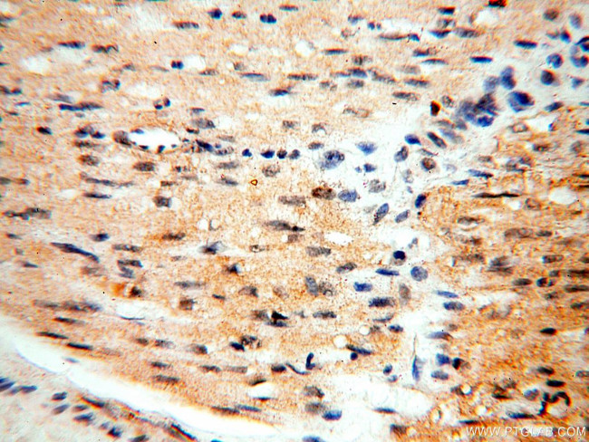 SGCG Antibody in Immunohistochemistry (Paraffin) (IHC (P))