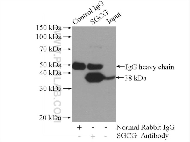 SGCG Antibody in Immunoprecipitation (IP)