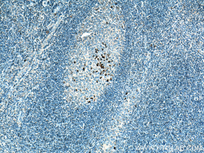 IL20 Antibody in Immunohistochemistry (Paraffin) (IHC (P))