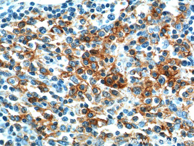 PD-1/CD279 Antibody in Immunohistochemistry (Paraffin) (IHC (P))