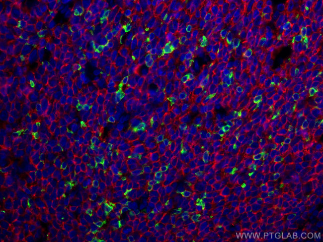 PD-1/CD279 Antibody in Immunohistochemistry (PFA fixed) (IHC (PFA))