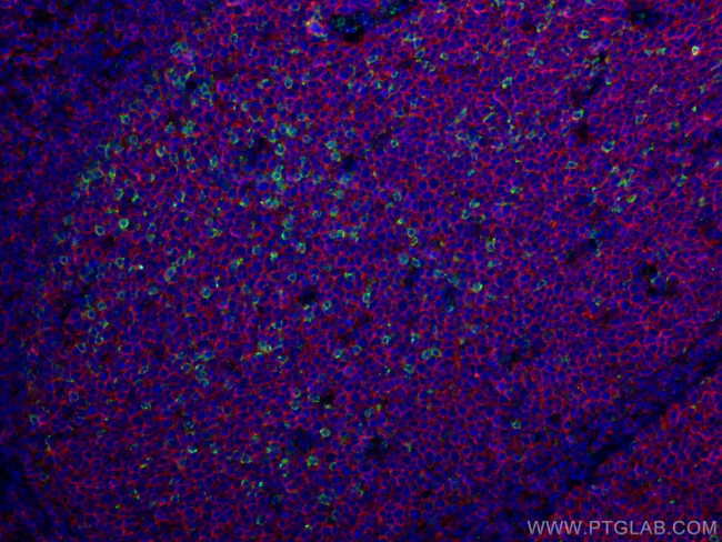 PD-1/CD279 Antibody in Immunohistochemistry (PFA fixed) (IHC (PFA))