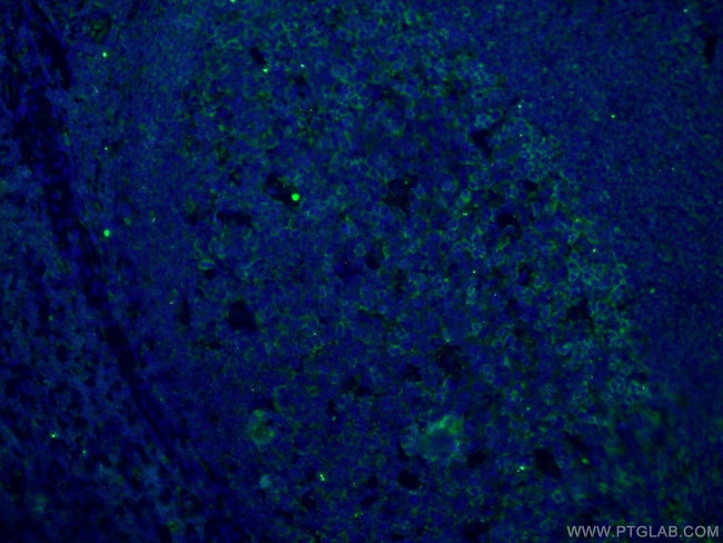 PD-1/CD279 Antibody in Immunohistochemistry (PFA fixed) (IHC (PFA))